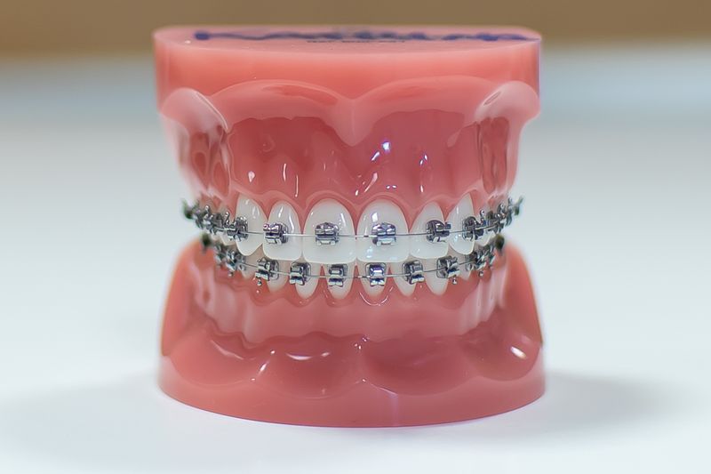Smile Maintenance